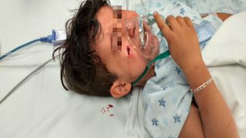 Fotos: Sicarios del narco dejan herido a niño tras matar a su papá, así le dejaron el rostro