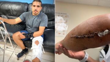 El oficial Ricardo Castillo sufrió graves heridas en su pierna y en su brazo izquierdos.