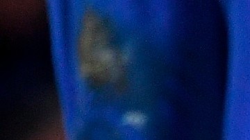 Lewandowski deberá estar enyesado durante diez días y luego iniciar la rehabilitación.