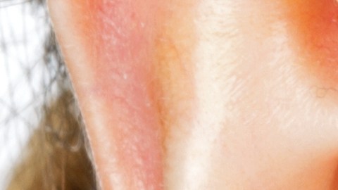 enfermedades-dermatologicas