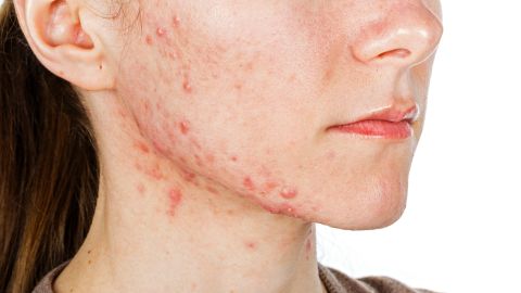 enfermedades-dermatologicas