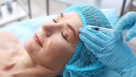 relleno-facial