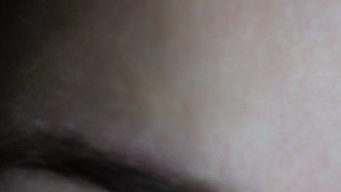 ojos rojos