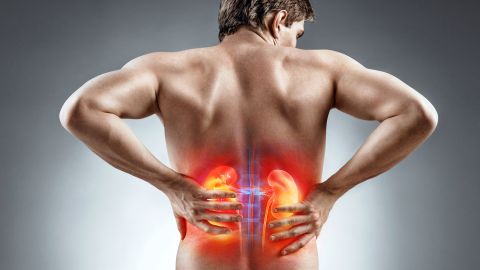 cáncer de riñón