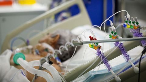 Se estima que el 5% de los infectados por el coronavirus requieren respiración asistida.