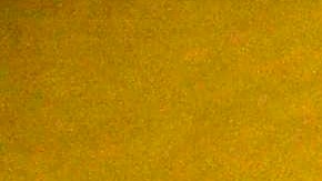 Adultos mayores son más vulnerables a la enfermedad.