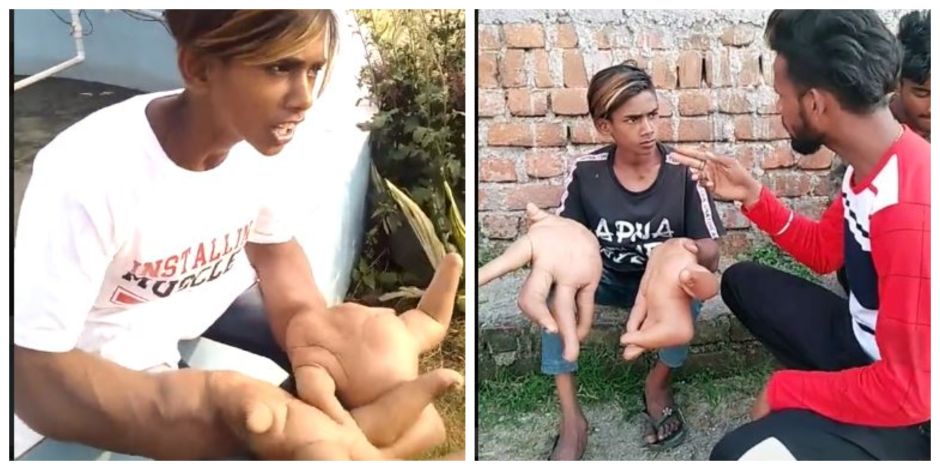 Niño se hace viral en TikTok por tener manos gigantes | La Opinión