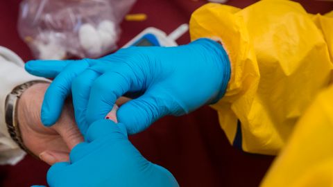 El doctor sufrió un severo dolor de cabeza y perdió el habla.