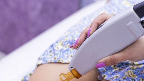 Depilación con láser en la piel de las piernas de una mujer.
