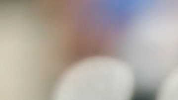 'Thor' será sometido a una cirugía de Tommy John.