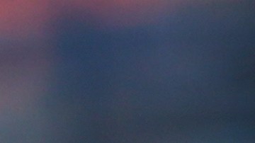 El pitcher necesitará seis semanas de recuperación.