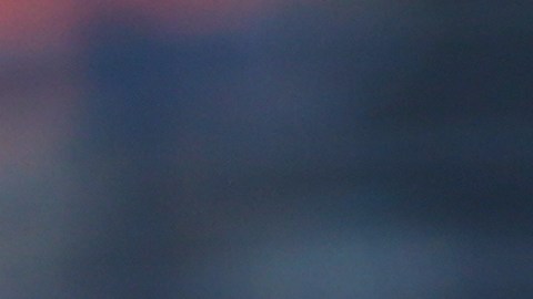 El pitcher necesitará seis semanas de recuperación.
