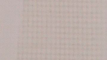 Un médico hace la prueba del coronavirus a un paciente en la localidad francesa de Burdeos.