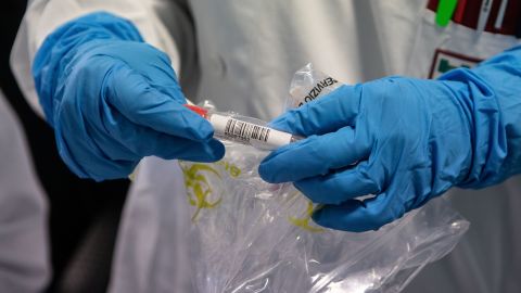 Prueba de coronavirus.