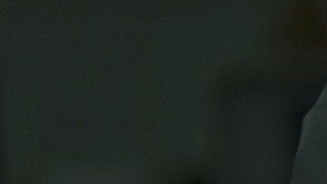 Imagen ilustrativa de un parto por cesárea.