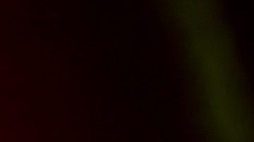 Zion estuvo hospitalizado en el hospital ABC de la Ciudad de México.