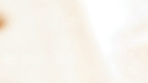 Kits para cambio de aceite.