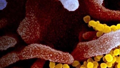 Imagen microscópica del coronavirus.