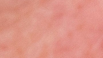 Otros países han examinado proporcionalmente a más personas.