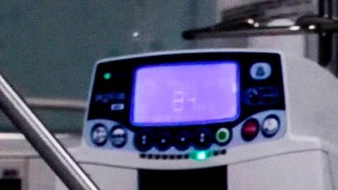 Algunos síntomas del COVID-19 han sorprendido a los médicos.