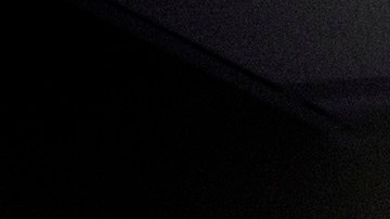 Los doctores dicen que esto les ha causado problemas psicológicos.