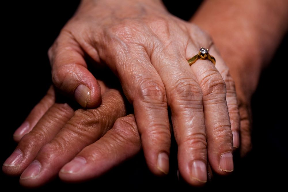 Imagen ilustrativa de las manos de una anciana.