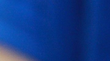 Productos para tratar las quemaduras leves.