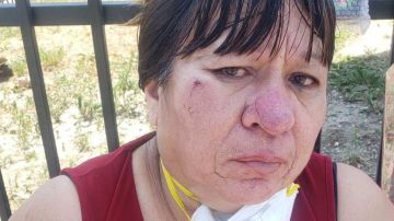 La Sra. Marisela Cuevas después del ataque