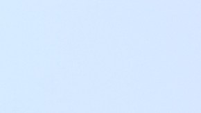 dientes ortodoncia férula