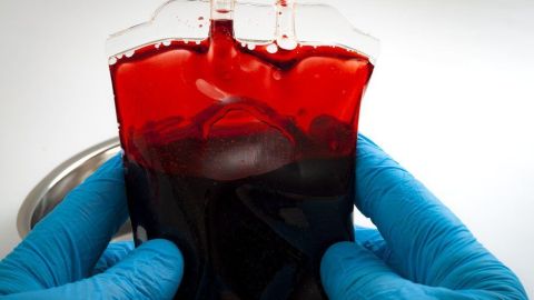 La "sangre dorada" es uno de los tipos de sangre más extraños.