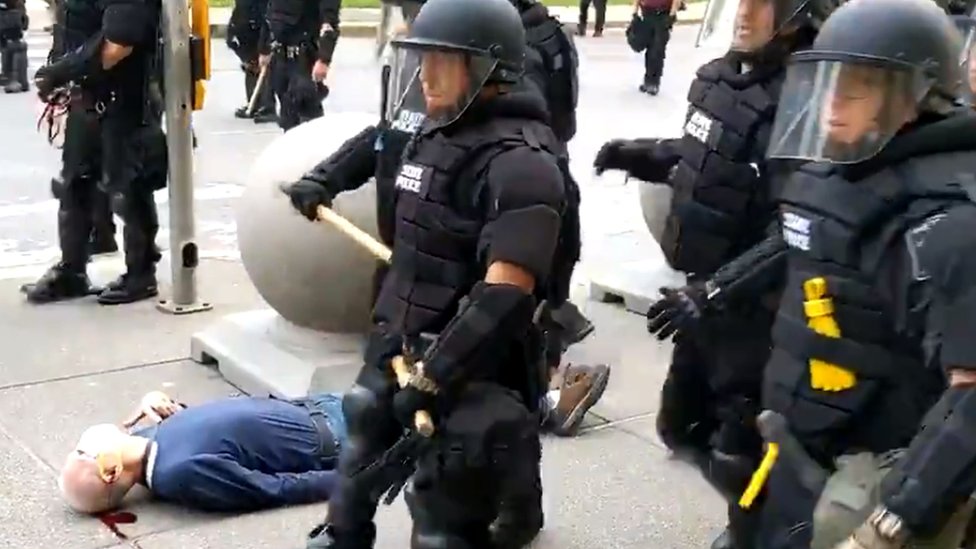 Un video muestra a dos agentes de policía que empujan a un hombre en Buffalo, NY, éste cae y termina herido en el suelo.