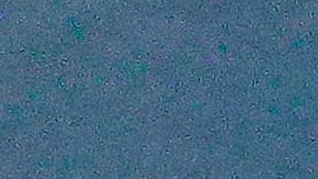 Una de las pasajeras murió por las complicaciones de COVID-19.