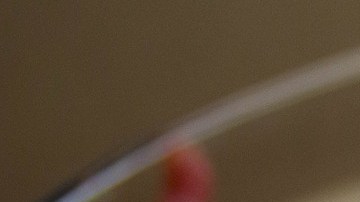 E. Coli puede causar deshidratación, diarrea y dolores abdominales.