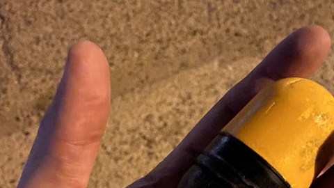 Heridas por las pelotas de goma que lanzan los policías a los manifestantes. (Cortesía)