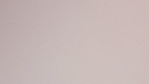 Radiación de las tomografías computarizadas podría generar cáncer