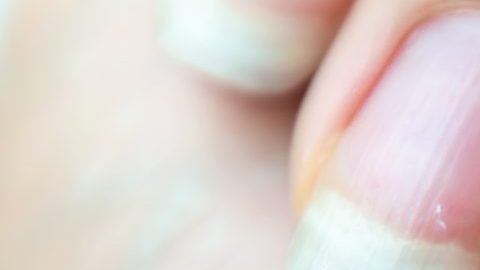 uñas