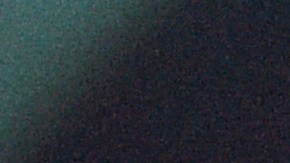 pulmones radiografía