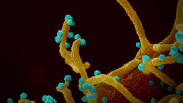 La célula infectada, siguiendo las instucciones del virus (en azul), desarrolla largos tentáculos para infectar otras células.