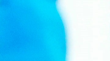 David Ospina tuvo que salir de cambio al minuto 28 del partido.