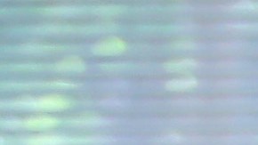 Un paciente es tratadio por coronavirus en California.