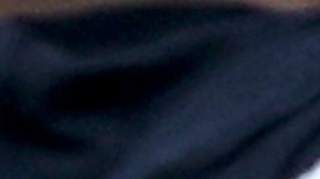 Masahiro Tanaka es atendido luego del violento golpe en la cabeza.