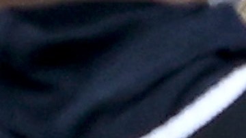 Masahiro Tanaka es atendido luego del violento golpe en la cabeza.