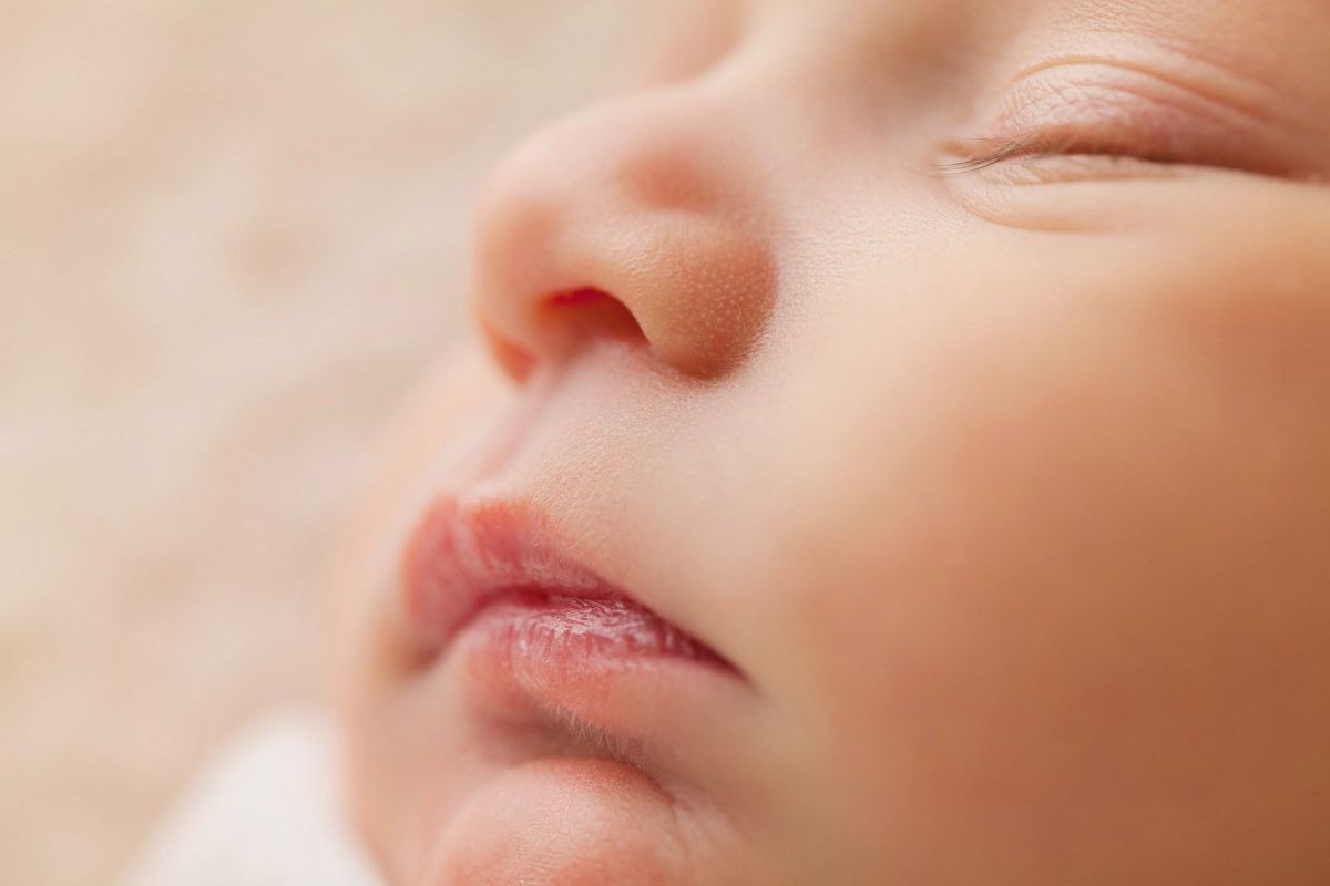 Solo uno de cada 100,000 recién nacidos nacen con esta condición.