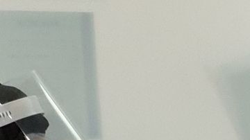 Será importante definir si se trata de reinfección o reactivación.