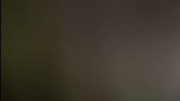 Imagen de Marcelo Labra tras recibir una agresión en Miami.