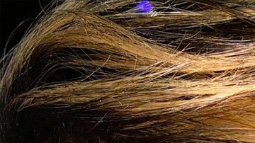 Andrea Puerta, de 29 años, y Eduardo Fernández, de 74, fueron agredidos brutalmente mientras utilizaban el Metromover en Miami.