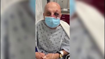 Eduardo Fernández, un anciano de 74 años, fue trasladado al hospital tras recibir una golpiza en el Metromover de Miami.
