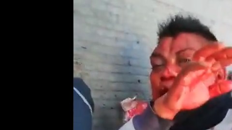 El sujeto recibió una fuerte golpiza.