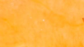 El melón también brinda beneficios al sistema digestivo.