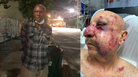 Robert Lee Ribbs, de 62 años, ya ha sido arrestado y se encuentra en una cárcel de Miami.